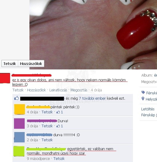 nem normális köröm
 
